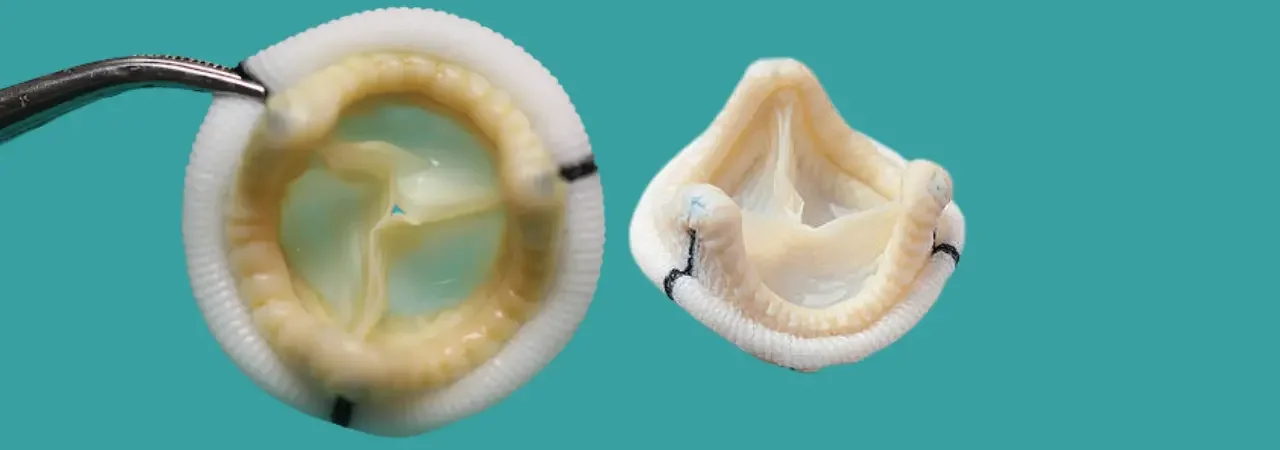 Biyolojik Kapak Protezi Nedir? Avantajları ve Dezavantajları