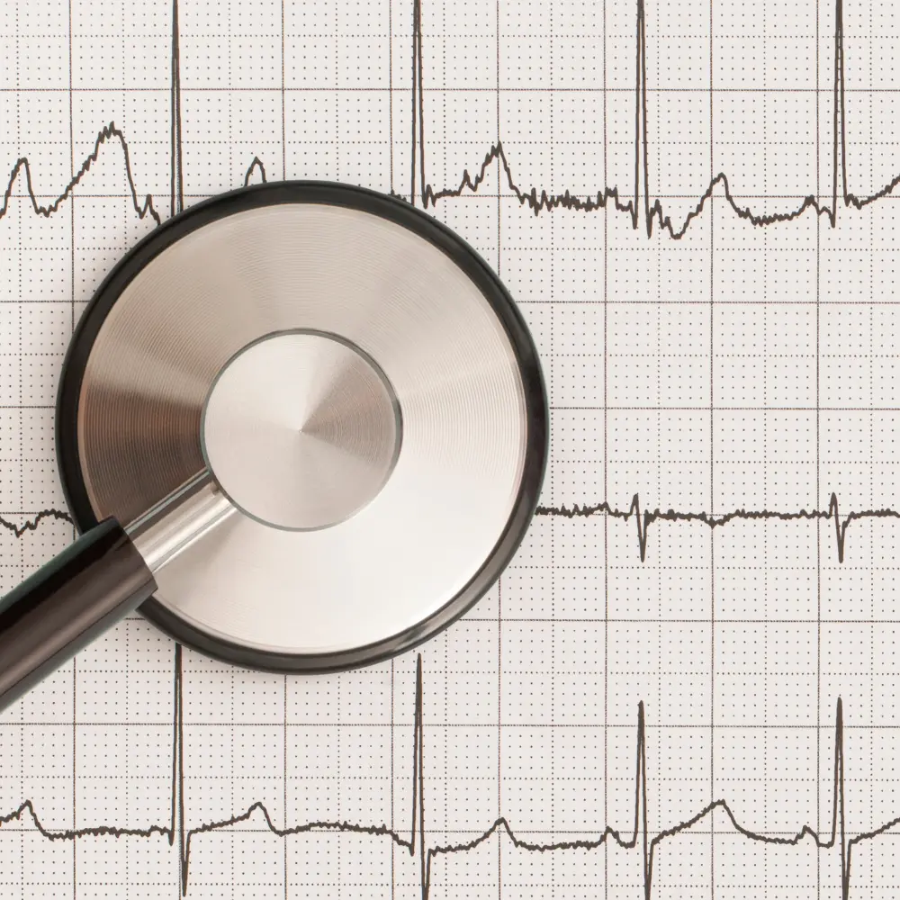 Çarpıntı / Aritmi