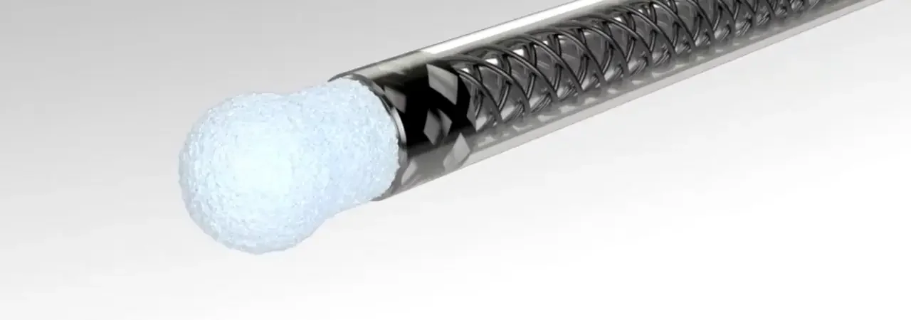 Kriyoablasyon (Cryo-Ablation) Nedir? Ne Zaman Uygulanır?